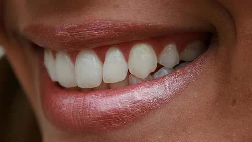 Come scegliere una clinica dentale all'estero in sicurezza: la guida
