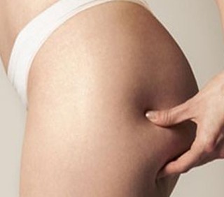Cellulite: nuove cure per combatterla