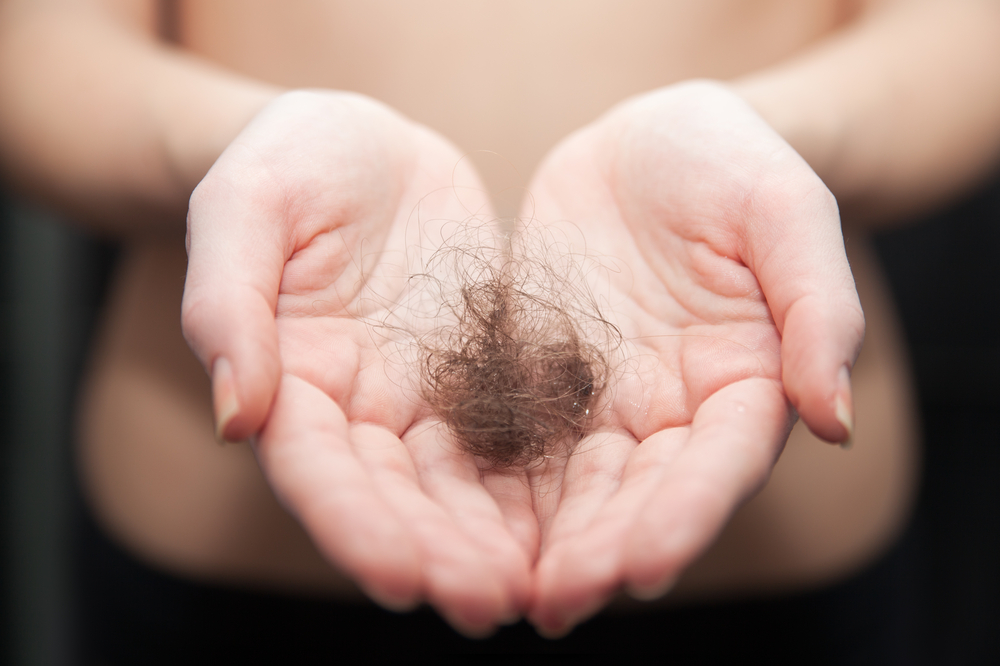 Caduta dei capelli: rimedi naturali per contrastarla Caduta dei capelli: rimedi naturali per contrastarla